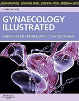 Gynaecology Illustrated, 6e